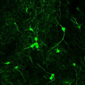 Strongly fluorescent P2rx7-expressing neurons in the bed nucleus of the stria terminalis.